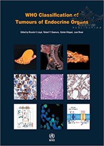 عکس WHO Classification of Tumours of Endocrine Organs, 4th Edition2017 طبقه بندی تومورهای اندام های غدد درون ریز