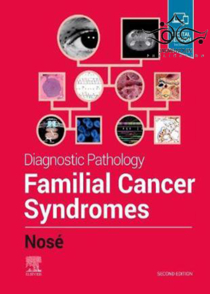 عکس Diagnostic Pathology: Familial Cancer Syndromes, 2nd Edition2020 آسیب شناسی تشخیصی: سندرم های سرطان خانوادگی