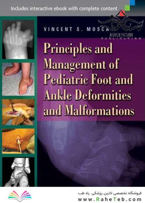 Principles and Management of Pediatric Foot and Ankle Deformities and Malformations2014 اصول و مدیریت ناهنجاری ها و ناهنجاری های پا و مچ پا در کودکان