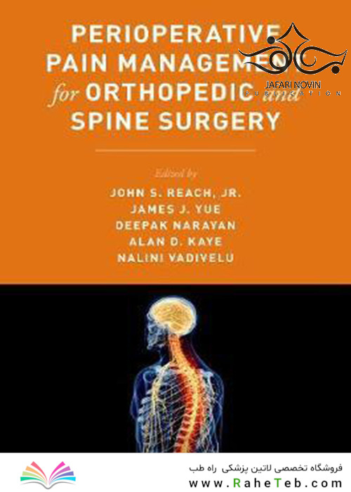 Perioperative Pain Management for Orthopedic and Spine Surgery2019 مدیریت درد بعد از عمل برای جراحی های ارتوپدی و ستون فقرات