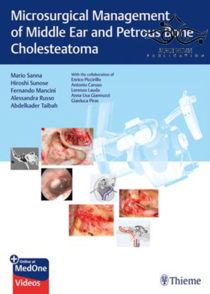 عکس Microsurgical Management of Middle Ear and Petrous Bone Cholesteatoma2019