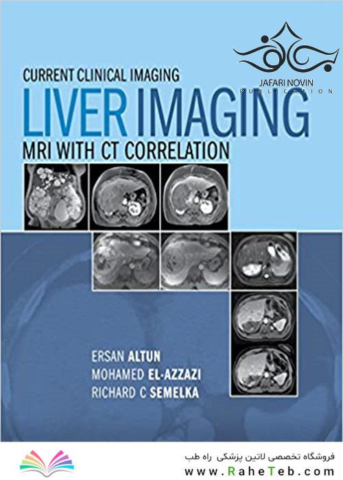Liver Imaging: MRI with CT Correlation (Current Clinical Imaging)2015 تصویربرداری از کبد: ام آر آی با همبستگی CT (تصویربرداری بالینی فعلی)