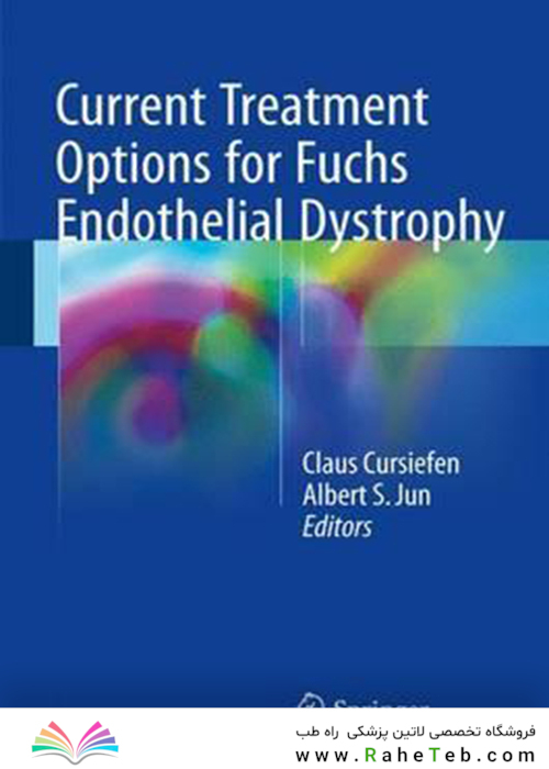 Current Treatment Options for Fuchs Endothelial Dystrophy2016 گزینه های درمانی فعلی برای دیستروفی اندوتلیال