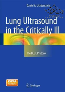 عکس Lung Ultrasound in the Critically Ill: The BLUE Protocol2015 سونوگرافی ریه در بیماران بحرانی: پروتکل BLUE