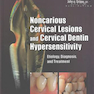 Noncarious Cervical Lesions and Cervical Dentin Hypersensitivity2017 ضایعات غیر سرطانی دهانه رحم و افزایش حساسیت عاج گردنی
