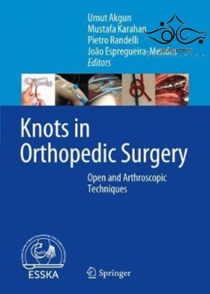 عکس Knots in Orthopedic Surgery: Open and Arthroscopic Techniques2018 گره در جراحی ارتوپدی: روشهای باز و آرتروسکوپی