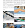 Fracture Reduction and Fixation Techniques: Upper Extremities2018