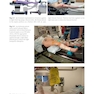 Fracture Reduction and Fixation Techniques: Upper Extremities2018