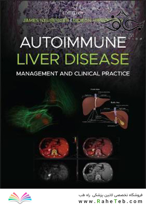 Autoimmune Liver Disease: Management and Clinical Practice2020 بیماری کبدی خود ایمنی: مدیریت و تمرین بالینی