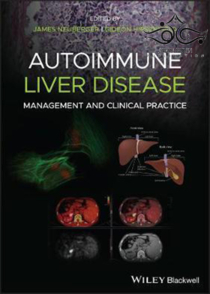 عکس Autoimmune Liver Disease: Management and Clinical Practice2020 بیماری کبدی خود ایمنی: مدیریت و تمرین بالینی