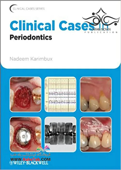 Clinical Cases in Periodontics (Clinical Cases (Dentistry) Book 42) 1st Edition موارد بالینی در پریودنتیکس