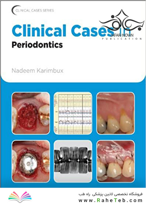Clinical Cases in Periodontics (Clinical Cases (Dentistry) Book 42) 1st Edition موارد بالینی در پریودنتیکس
