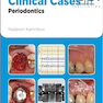 Clinical Cases in Periodontics (Clinical Cases (Dentistry) Book 42) 1st Edition موارد بالینی در پریودنتیکس