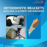 Orthodontic Brackets: Selection,Placement and Debonding2015 براکت های ارتودنسی: انتخاب ، جاگذاری و رد کردن