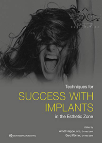 عکس Techniques for Success With Implants in the Esthetic Zone2019
