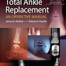 Total Ankle Replacement: An Operative Manual First Edition2014 تعویض کامل مچ پا: یک کتابچه راهنمای عملیاتی
