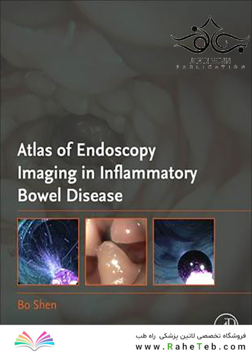 Atlas of Endoscopy Imaging in Inflammatory Bowel Disease2019 تصویربرداری اطلس از آندوسکوپی در بیماری التهابی روده