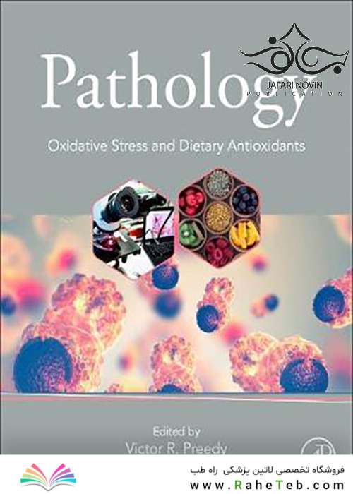 Pathology: Oxidative Stress and Dietary Antioxidants 2020