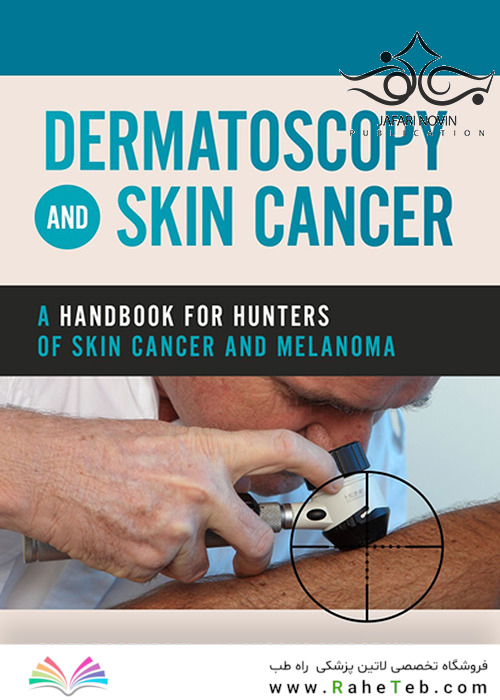 Dermatoscopy and Skin Cancer : A handbook for hunters of skin cancer and melanoma 2019 درماتوسکوپی و سرطان پوست: کتاب راهنما سرطان پوست