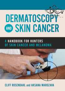 عکس Dermatoscopy and Skin Cancer : A handbook for hunters of skin cancer and melanoma 2019 درماتوسکوپی و سرطان پوست: کتاب راهنما سرطان پوست