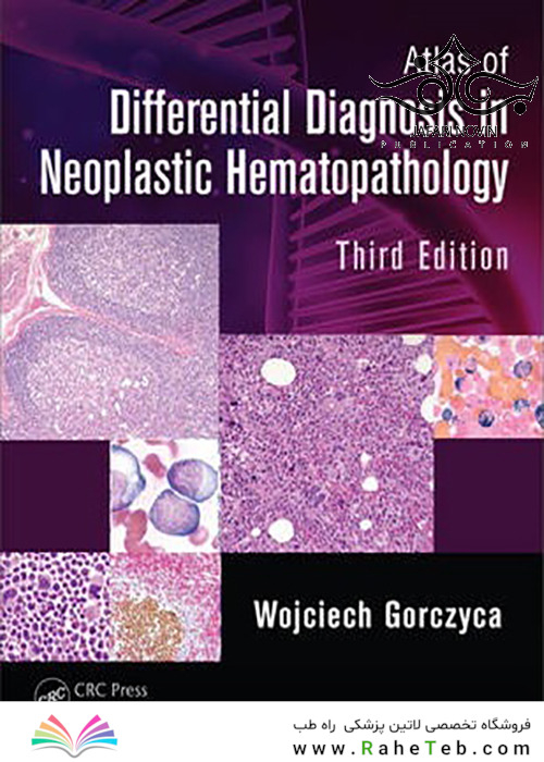 Atlas of Differential Diagnosis in Neoplastic Hematopathology, 3rd Edition2014 اطلس تشخیص افتراقی در خون شناسی نئوپلاستیک