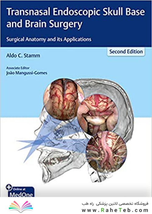 Transnasal Endoscopic Skull Base and Brain Surgery: Surgical Anatomy and its Applicationsجراحی پایه و مغز آندوسکوپی جمجمه: آناتومی جراحی و کاربردهای آن