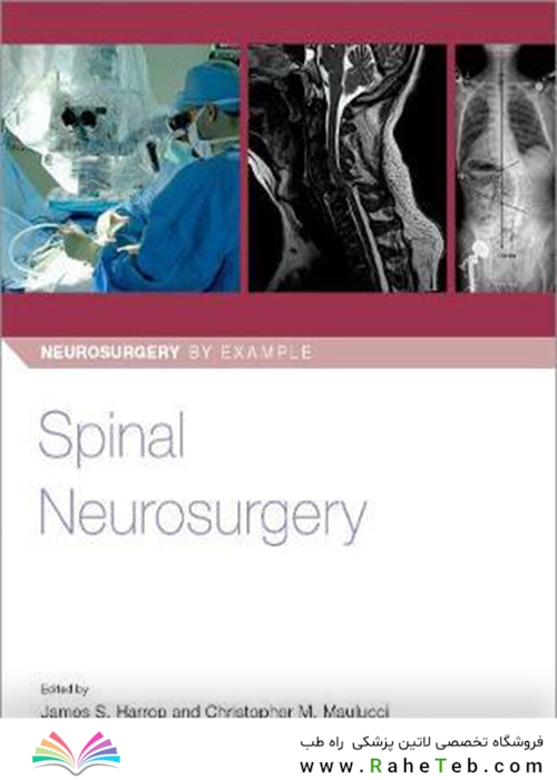 Spinal Neurosurgery (Neurosurgery by Example)2019جراحی مغز و اعصاب نخاعی (جراحی مغز و اعصاب به عنوان مثال)
