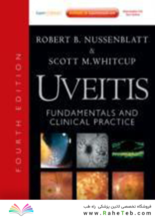 Uveitis: Fundamentals and Clinical Practice: Expert Consult - Online and Print2011یوئیت: اصول و عمل بالینی: مشاوره متخصص - بصورت آنلاین و چاپی