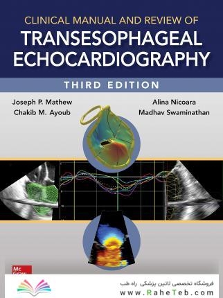 راهنمای بالینی و بررسی اکوکاردیوگرافی انتقال دهنده Clinical Manual and Review of Transesophageal Echocardiography