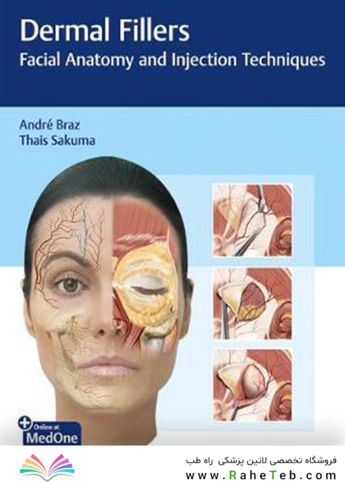 Dermal Fillers : Facial Anatomy and Injection Techniques2020