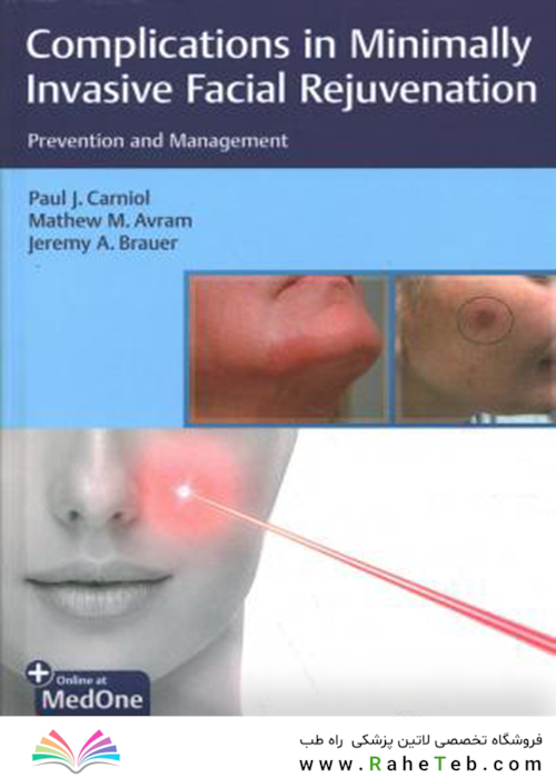 Complications in Minimally Invasive Facial Rejuvenation: Prevention and Management2020عوارض جوانسازی صورت با حداقل تهاجم
