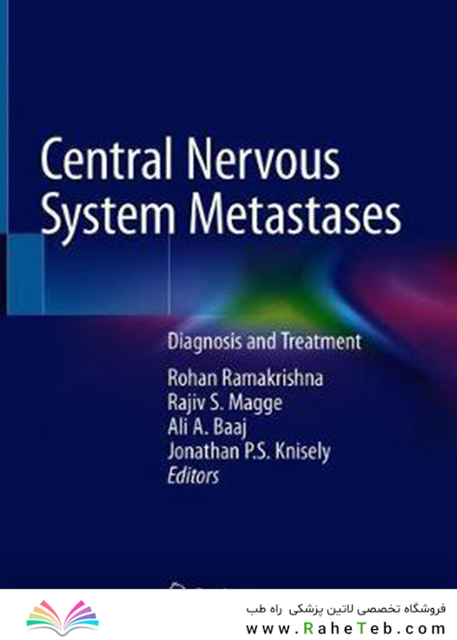 Central Nervous System Metastases: Diagnosis and Treatment2020متاستازهای سیستم عصبی مرکزی: تشخیص و درمان