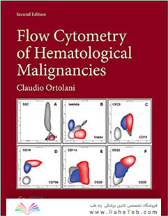 Flow Cytometry of Hematological Malignancies