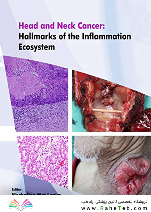 Head and Neck Cancer: Hallmarks of The Inflammation Ecosystem-Volume 2  2021 سرطان سر و گردن: نشانه های اکوسیستم التهاب-جلد 2