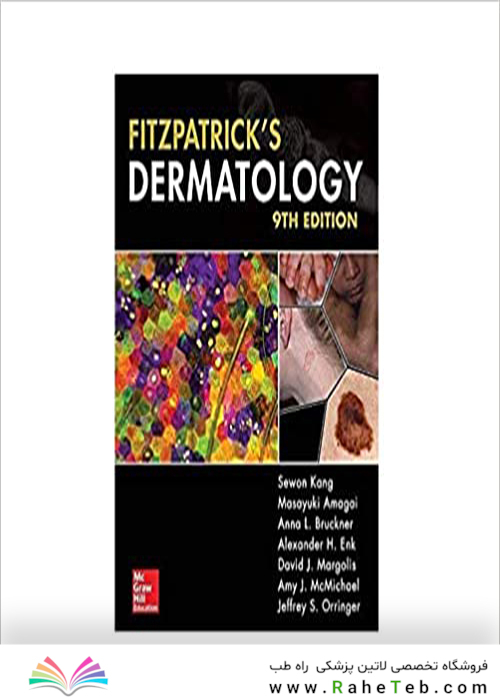 Fitzpatrick