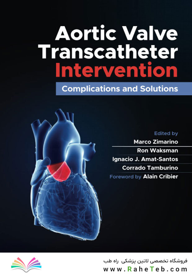 Aortic Valve Transcatheter Intervention: Complications and Solutions