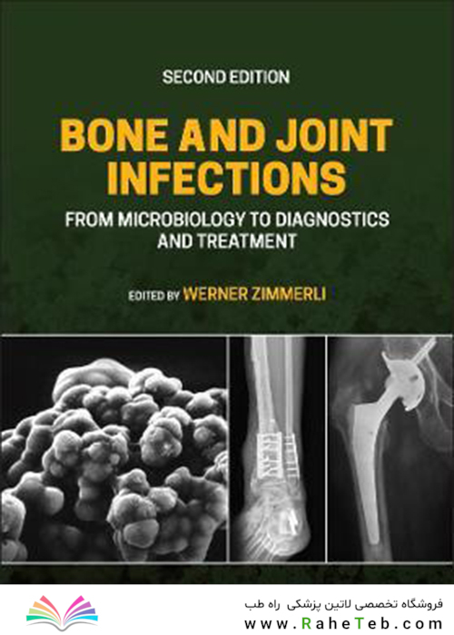 2021 Back to results  Bone and Joint Infections: From Microbiology to Diagnostics and Treatment 2nd Edition