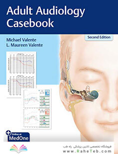 Adult Audiology Casebook 2nd Edicion