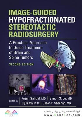 Image-Guided Hypofractionated Stereotactic Radiosurgery : A Practical Approach to Guide Treatment of Brain and Spine Tumors2021