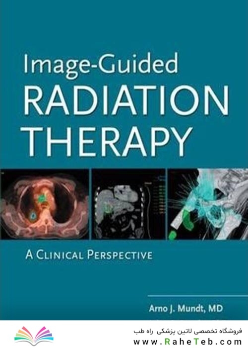 Image-Guided Radiation Therapy (IGRT): A Clinical Perspectiveپرتودرمانی با هدایت تصویر (IGRT): دیدگاه بالینی