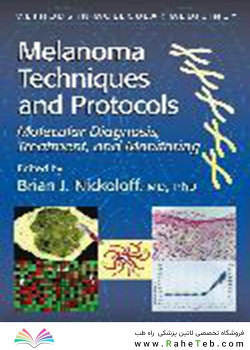 Melanoma Techniques and Protocols : Molecular Diagnosis, Treatment, and Monitoring2001  تکنیک ها و پروتکل های ملانوم: تشخیص مولکولی ، درمان و نظارت