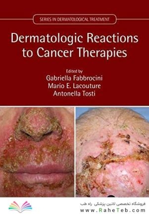 Dermatologic Reactions to Cancer Therapies2019واکنشهای پوستی به درمانهای سرطان