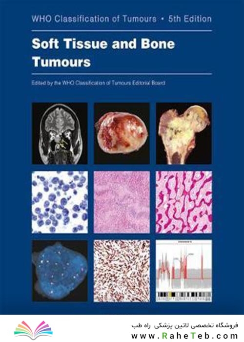 WHO classification of tumours of soft tissue and bone tumours 2020
