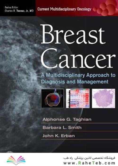 Breast Cancer : A Multidisciplinary Approach to Diagnosis and Managementسرطان پستان: رویکرد چندرشته ای در تشخیص و مدیریت