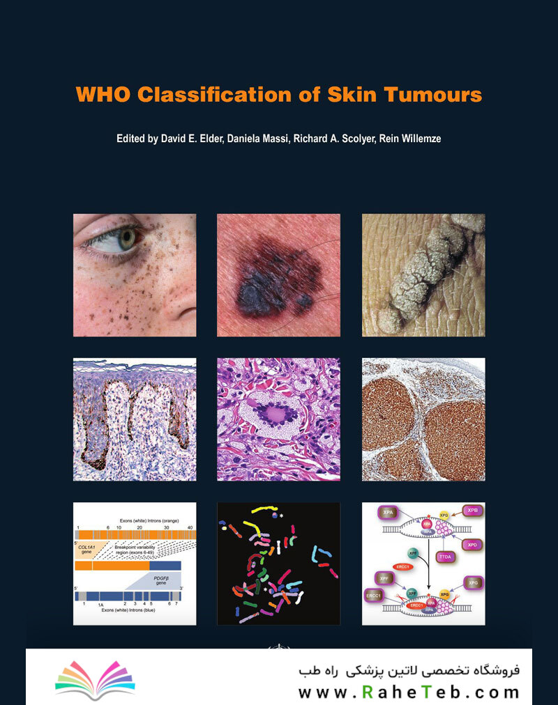 WHO Classification of Skin Tumours : WHO Classification of Tumours, Volume 11