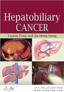 Hepatobiliary Cancer 1st Edicion
