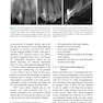 Minimally Invasive Approaches in Endodontic Practice2021