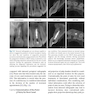 Minimally Invasive Approaches in Endodontic Practice2021