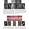 Minimally Invasive Approaches in Endodontic Practice2021