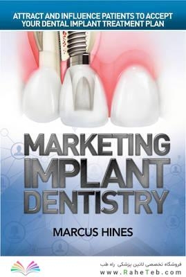 Marketing Implant Dentistry : Attract and Influence Patients to Accept Your Dental Implant Treatment Plan